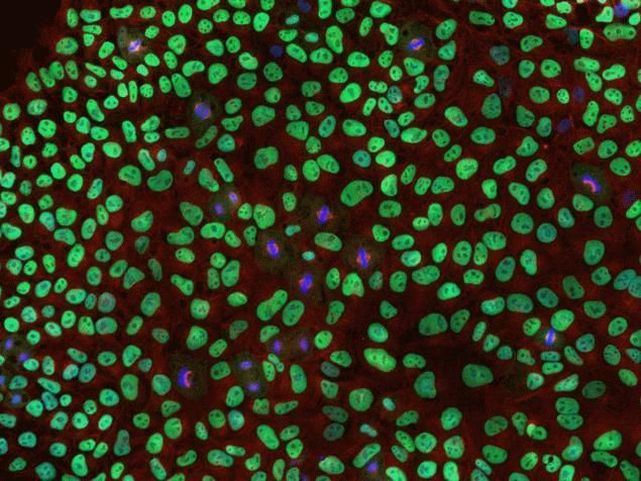 Rabbit IgG (H+L) Highly Cross-Adsorbed Secondary Antibody in Immunocytochemistry (ICC/IF)