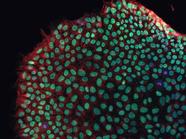 Rabbit IgG (H+L) Highly Cross-Adsorbed Secondary Antibody in Immunocytochemistry (ICC/IF)