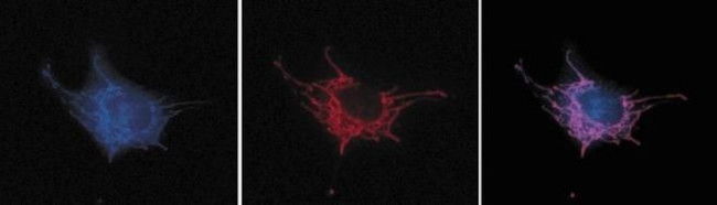 Mouse IgG (H+L) Cross-Adsorbed Secondary Antibody in Immunocytochemistry (ICC/IF)