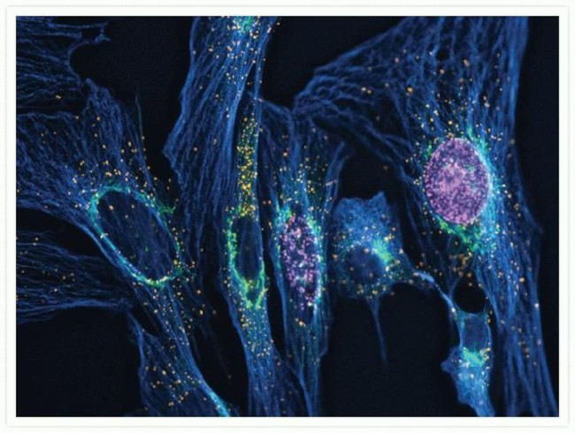 Mouse IgG (H+L) Cross-Adsorbed Secondary Antibody in Immunocytochemistry (ICC/IF)