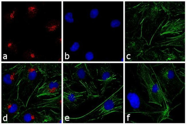 Rabbit IgG (H+L) Cross-Adsorbed Secondary Antibody in Immunocytochemistry (ICC/IF)