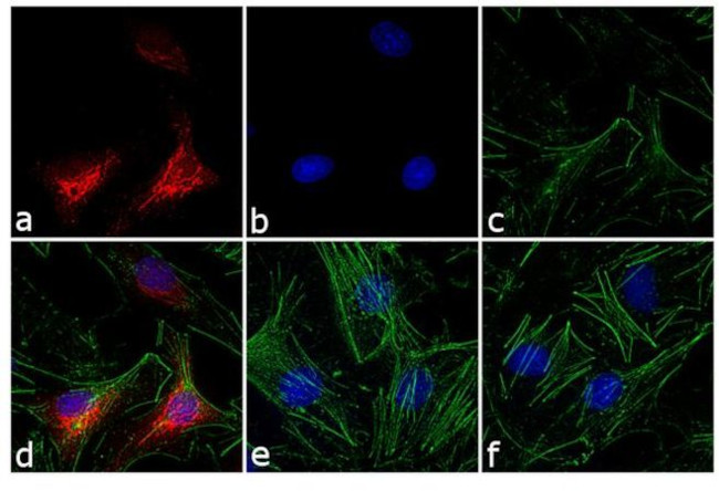 Rabbit IgG (H+L) Cross-Adsorbed Secondary Antibody in Immunocytochemistry (ICC/IF)