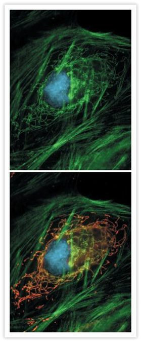 GFP Antibody in Immunocytochemistry (ICC/IF)