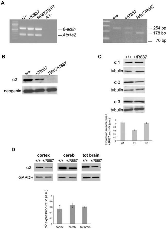 ATP1A3 Antibody in Western Blot (WB)