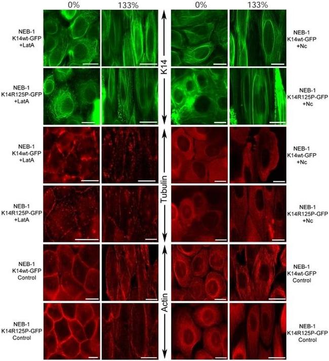 alpha Tubulin Antibody in Immunohistochemistry (IHC)