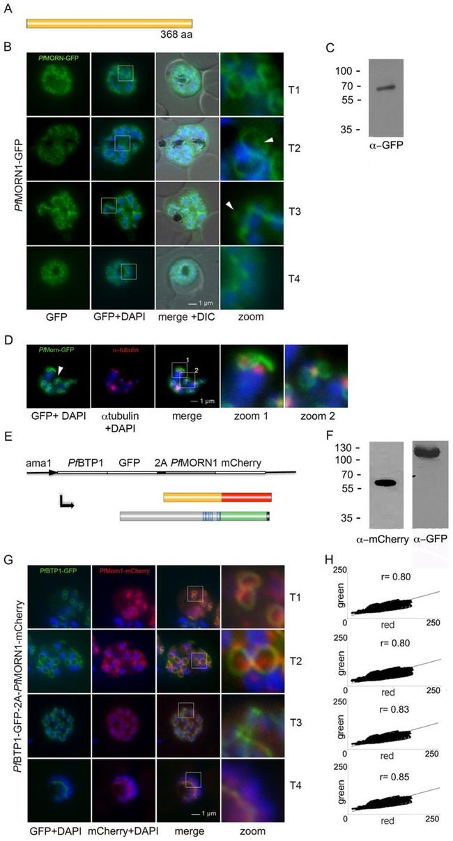 alpha Tubulin Antibody in Immunocytochemistry (ICC/IF)