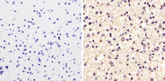 alpha Tubulin Antibody in Immunohistochemistry (Paraffin) (IHC (P))