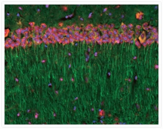 alpha Tubulin Antibody in Immunohistochemistry (IHC)