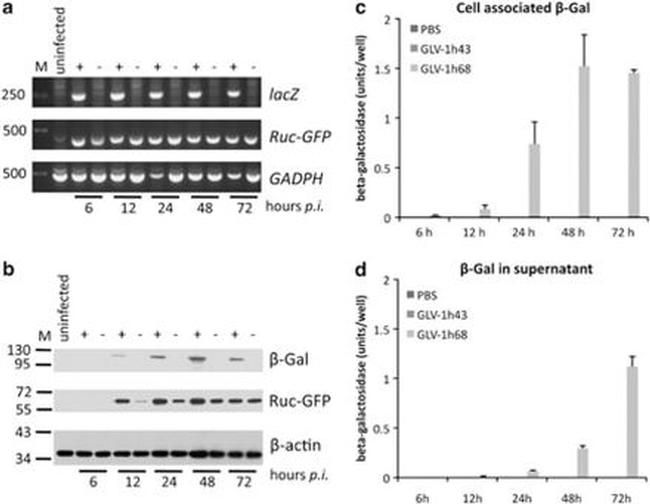 beta Galactosidase Antibody in Western Blot (WB)