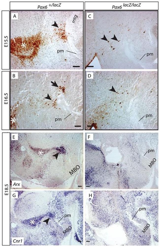 beta Galactosidase Antibody in Immunohistochemistry (Paraffin) (IHC (P))