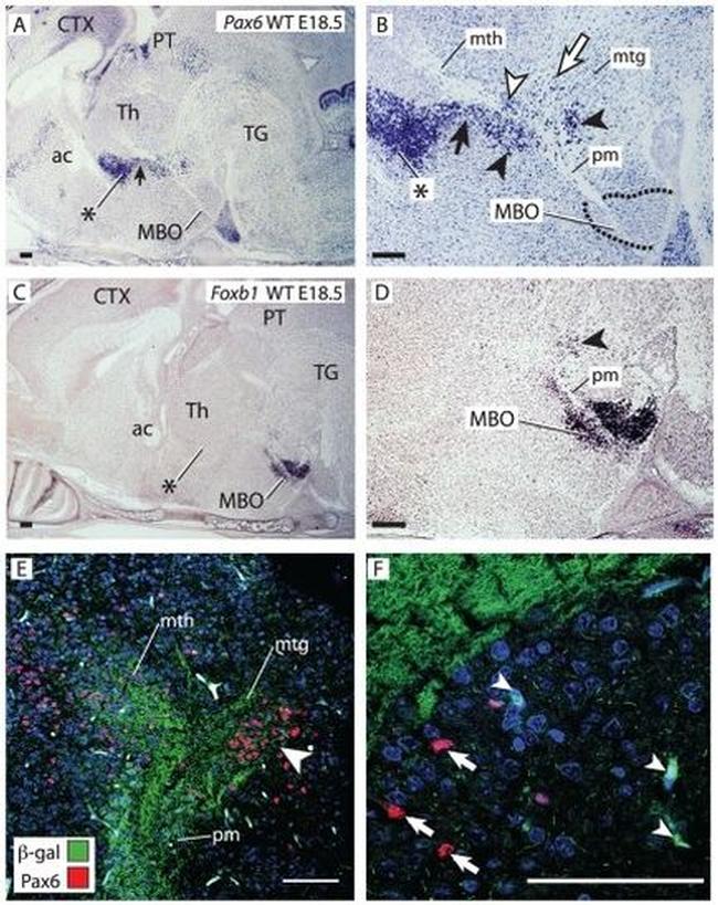 beta Galactosidase Antibody in Immunohistochemistry (Paraffin) (IHC (P))