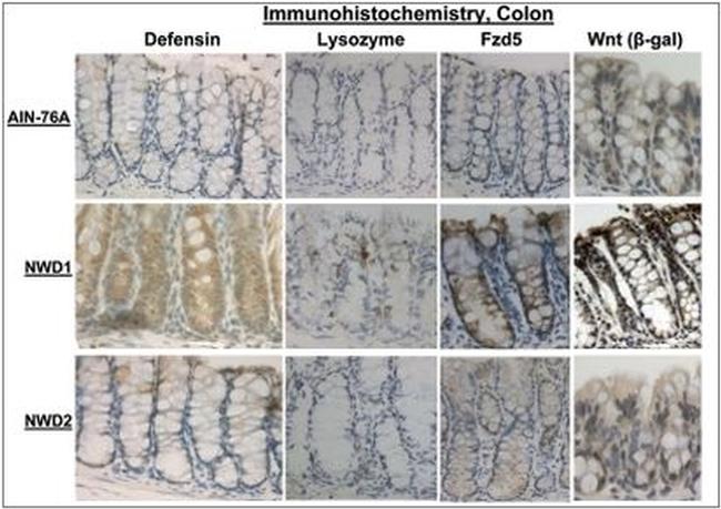 beta Galactosidase Antibody in Immunohistochemistry (IHC)