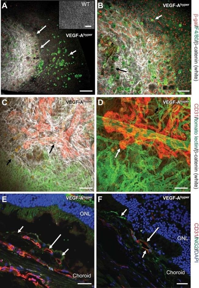 beta Galactosidase Antibody in Immunohistochemistry (IHC)