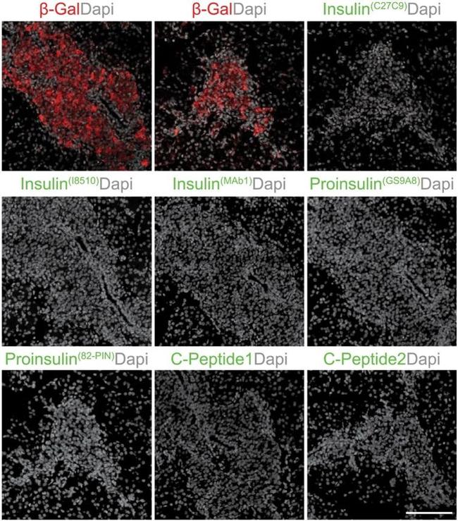 beta Galactosidase Antibody in Immunohistochemistry (IHC)