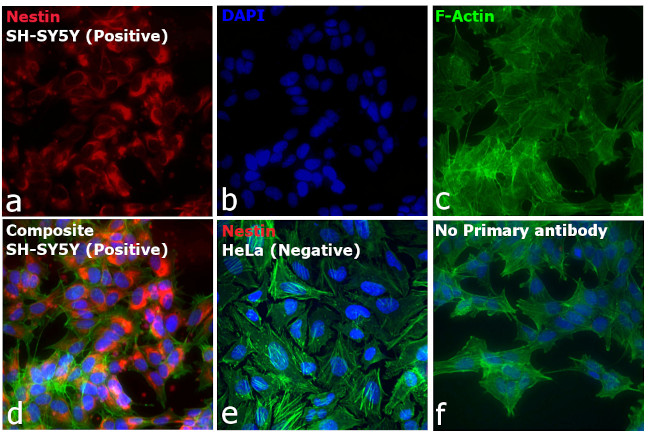 Mouse IgG (H+L) Highly Cross-Adsorbed Secondary Antibody in Immunocytochemistry (ICC/IF)