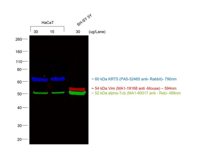 Rabbit IgG (H+L) Cross-Adsorbed Secondary Antibody in Western Blot (WB)