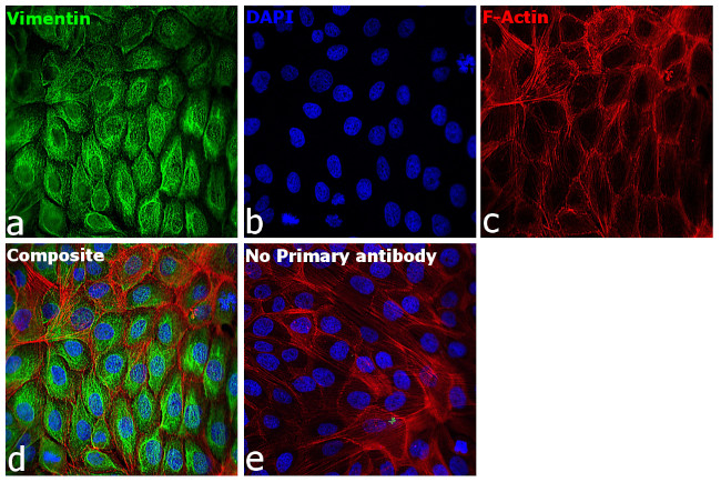 Rabbit IgG (H+L) Secondary Antibody in Immunocytochemistry (ICC/IF)