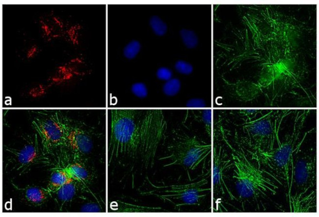 Rabbit IgG (H+L) Secondary Antibody in Immunocytochemistry (ICC/IF)