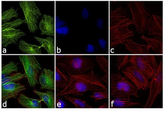 Rabbit IgG (H+L) Cross-Adsorbed Secondary Antibody in Immunocytochemistry (ICC/IF)