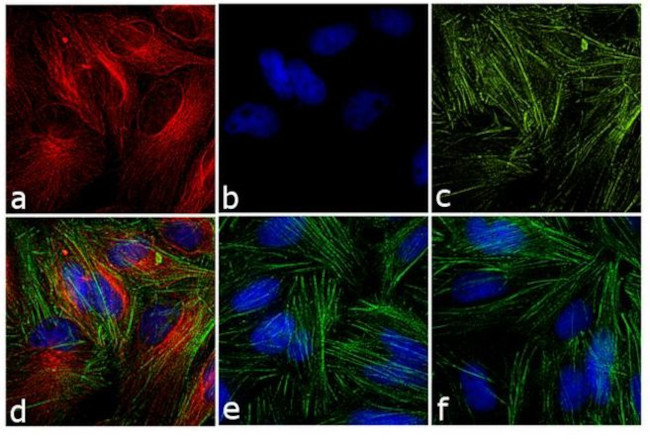 Mouse IgG (H+L) Secondary Antibody in Immunocytochemistry (ICC/IF)