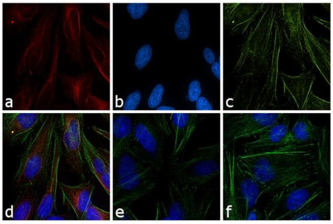 Mouse IgG (H+L) Cross-Adsorbed Secondary Antibody in Immunocytochemistry (ICC/IF)