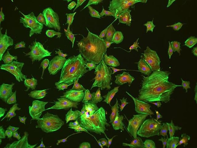 Mouse IgG (H+L) Highly Cross-Adsorbed Secondary Antibody in Immunocytochemistry (ICC/IF)