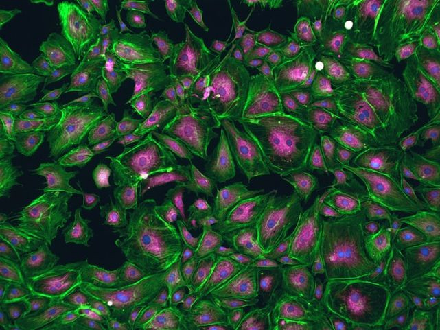 Mouse IgG (H+L) Highly Cross-Adsorbed Secondary Antibody in Immunocytochemistry (ICC/IF)