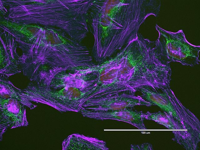 Mouse IgG (H+L) Highly Cross-Adsorbed Secondary Antibody in Immunocytochemistry (ICC/IF)