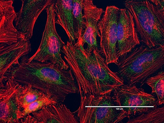 Mouse IgG (H+L) Highly Cross-Adsorbed Secondary Antibody in Immunocytochemistry (ICC/IF)