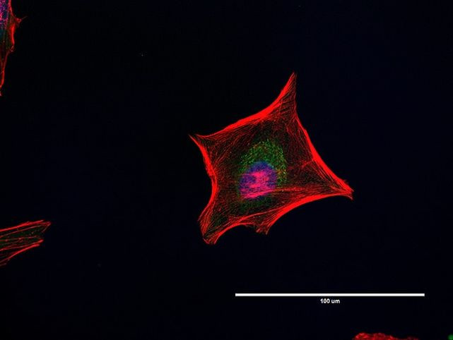 Mouse IgG (H+L) Highly Cross-Adsorbed Secondary Antibody in Immunocytochemistry (ICC/IF)