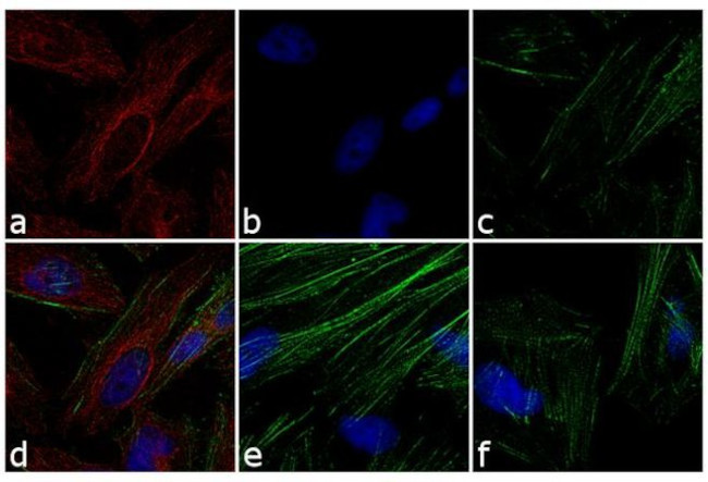 Mouse IgG Fc Secondary Antibody in Immunocytochemistry (ICC/IF)