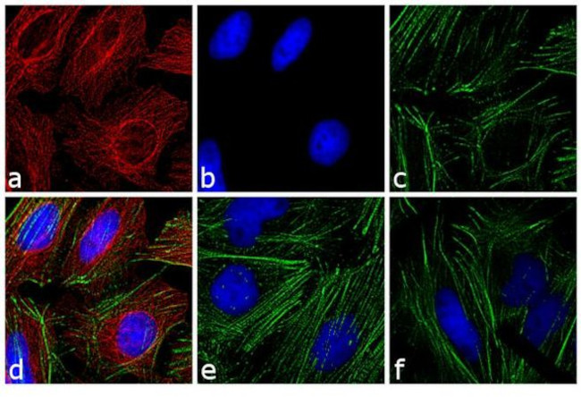 Mouse IgG Fc Cross-Adsorbed Secondary Antibody in Immunocytochemistry (ICC/IF)