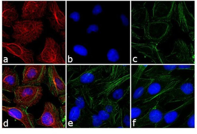 Rabbit IgG (H+L) Secondary Antibody in Immunocytochemistry (ICC/IF)