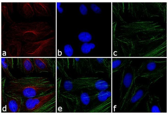 Rabbit IgG (H+L) Cross-Adsorbed Secondary Antibody in Immunocytochemistry (ICC/IF)