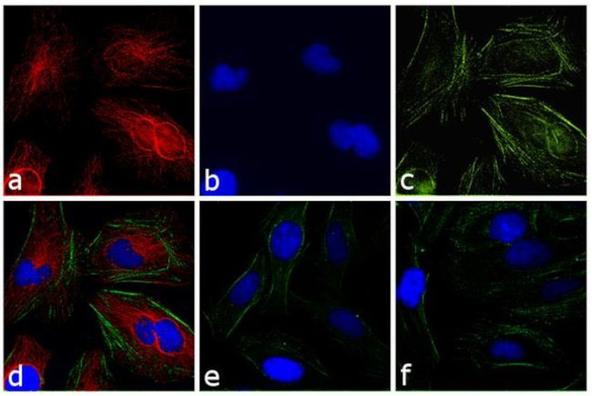 Rabbit IgG (H+L) Highly Cross-Adsorbed Secondary Antibody in Immunocytochemistry (ICC/IF)