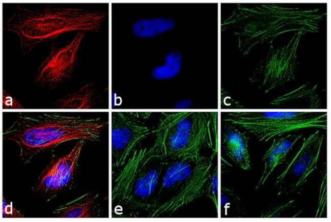 Rabbit IgG Fc Cross-Adsorbed Secondary Antibody in Immunocytochemistry (ICC/IF)