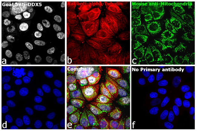 Mouse IgG (H+L) Secondary Antibody in Immunocytochemistry (ICC/IF)