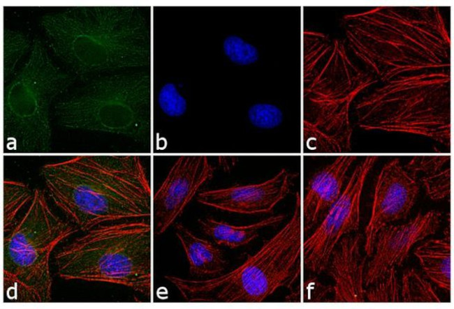 Mouse IgG (H+L) Cross-Adsorbed Secondary Antibody in Immunocytochemistry (ICC/IF)