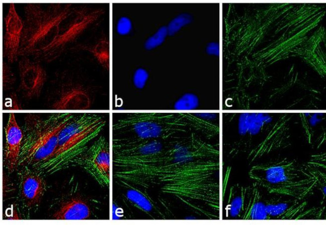 Mouse IgG (H+L) Cross-Adsorbed Secondary Antibody in Immunocytochemistry (ICC/IF)