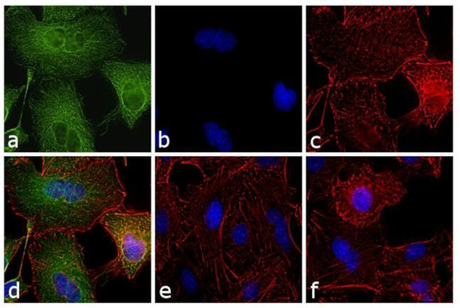 Rat IgG (H+L) Secondary Antibody in Immunocytochemistry (ICC/IF)