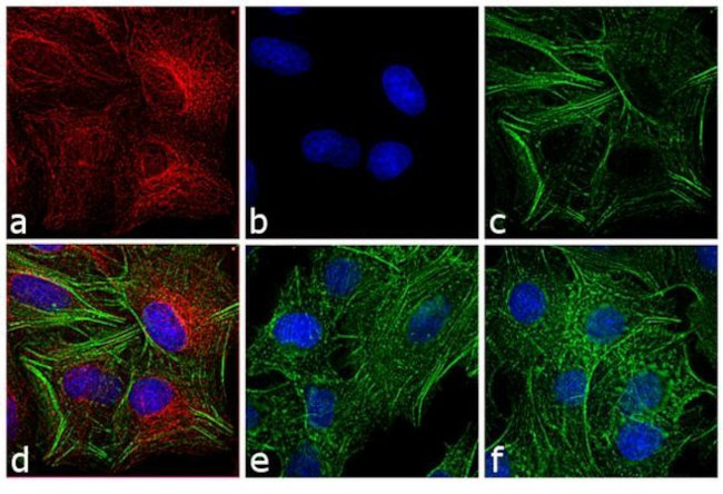 Rat IgG (H+L) Secondary Antibody in Immunocytochemistry (ICC/IF)