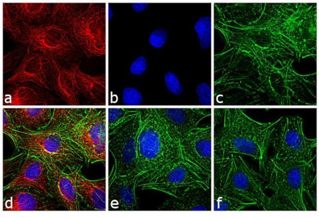 Rat IgG (H+L) Highly Cross-Adsorbed Secondary Antibody in Immunocytochemistry (ICC/IF)