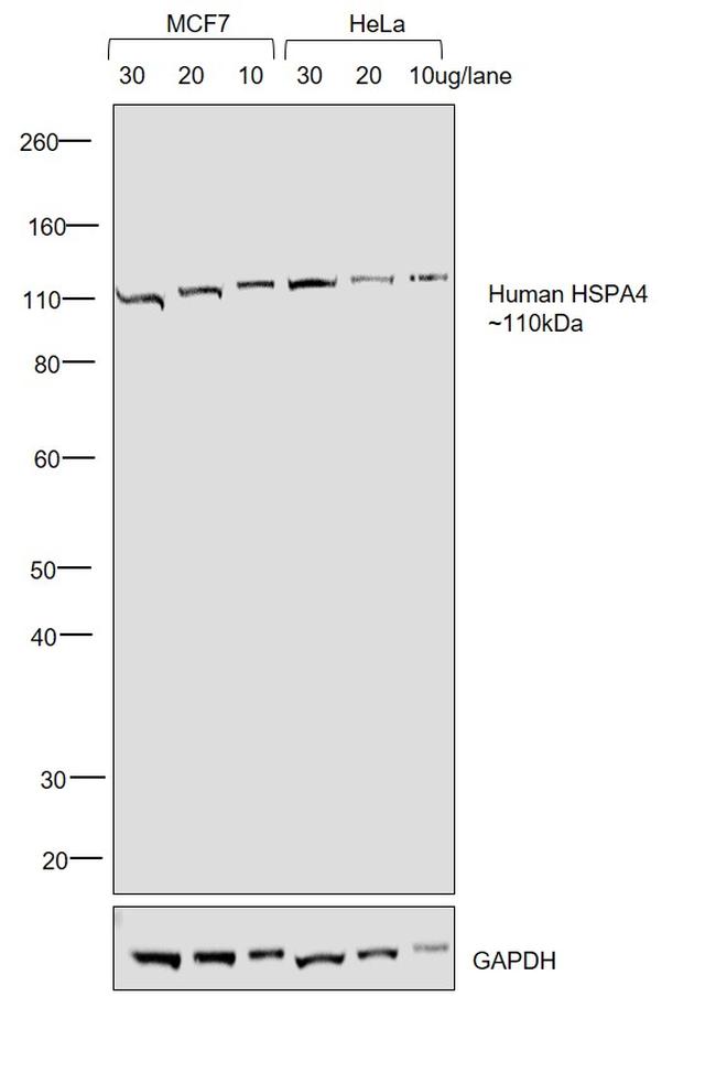 Human IgG Fc Highly Cross-Adsorbed Secondary Antibody in Western Blot (WB)