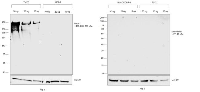 Human Kappa Light Chain Cross-Adsorbed Secondary Antibody in Western Blot (WB)