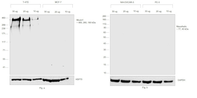 Human Kappa Light Chain Cross-Adsorbed Secondary Antibody