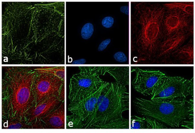 Rat IgG (H+L) Secondary Antibody in Immunocytochemistry (ICC/IF)