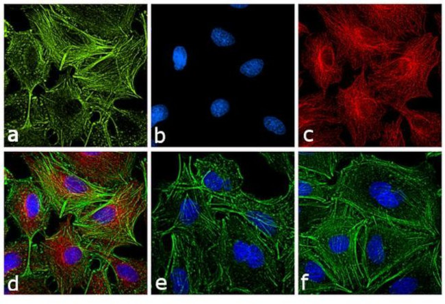 Rat IgG (H+L) Secondary Antibody in Immunocytochemistry (ICC/IF)