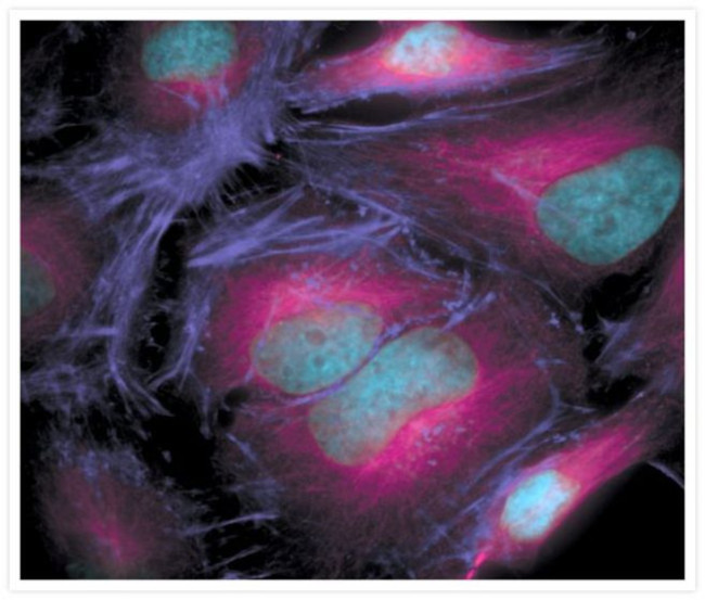 Mouse IgG (H+L) Cross-Adsorbed Secondary Antibody in Immunocytochemistry (ICC/IF)