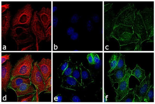 Mouse IgG (H+L) Highly Cross-Adsorbed Secondary Antibody in Immunocytochemistry (ICC/IF)