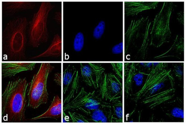 Mouse IgG (H+L) Cross-Adsorbed Secondary Antibody in Immunocytochemistry (ICC/IF)